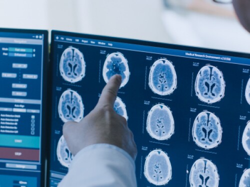 radiologic imaging professionals analyzing brain scan