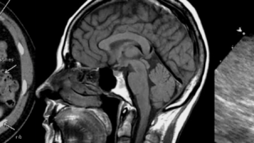radiologic-imaging-sciences-technology.png
