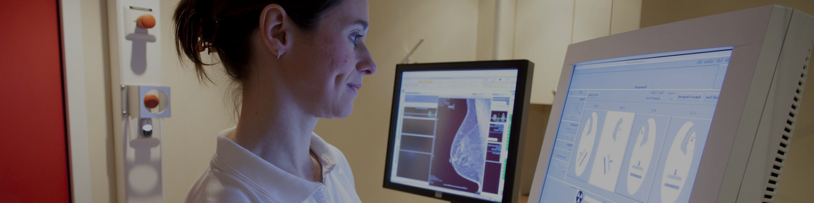 mammography.png