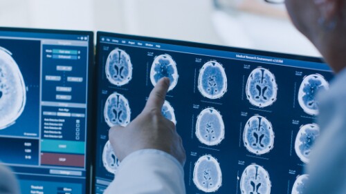 radiologic imaging professionals analyzing brain scan