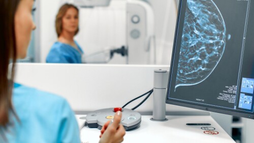 mammographer analyzes image from mammogram